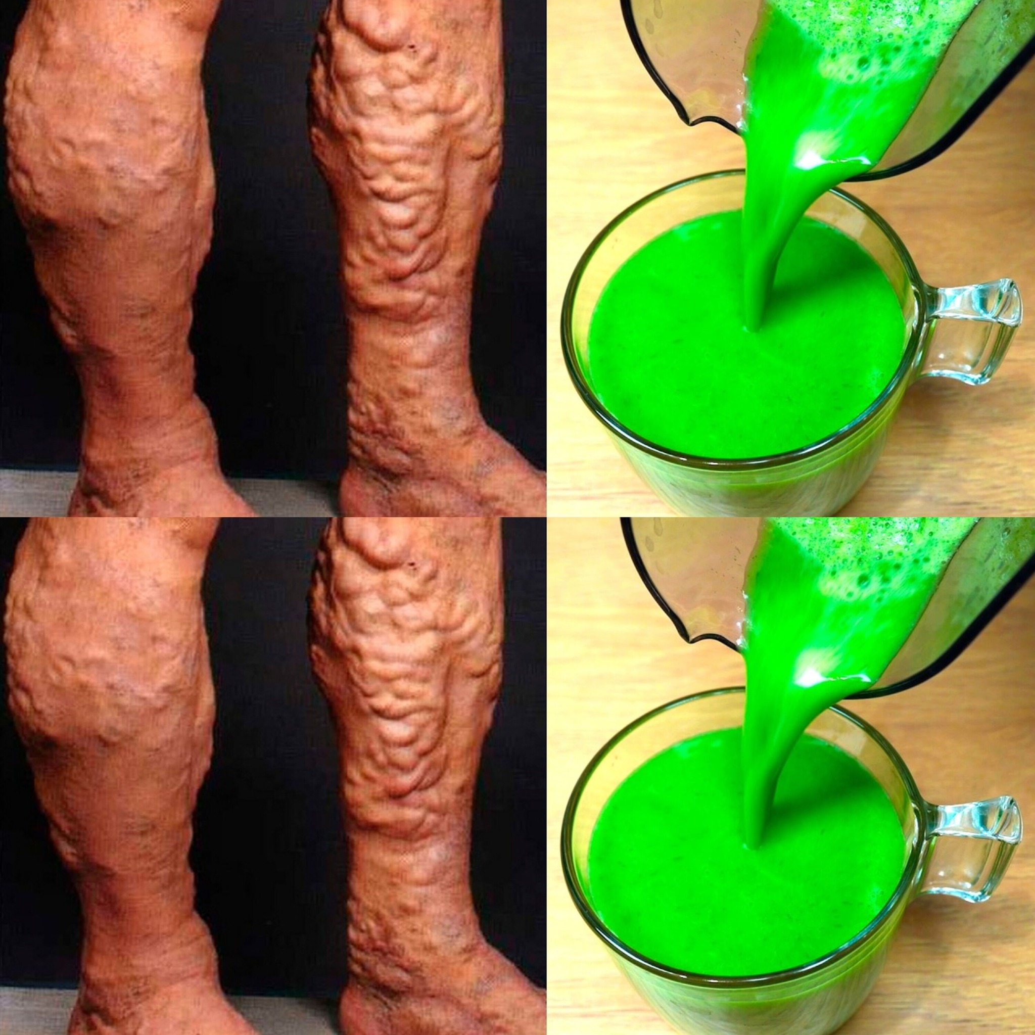 One Cup to Soothe Varicose Veins—No More Heavy Legs!