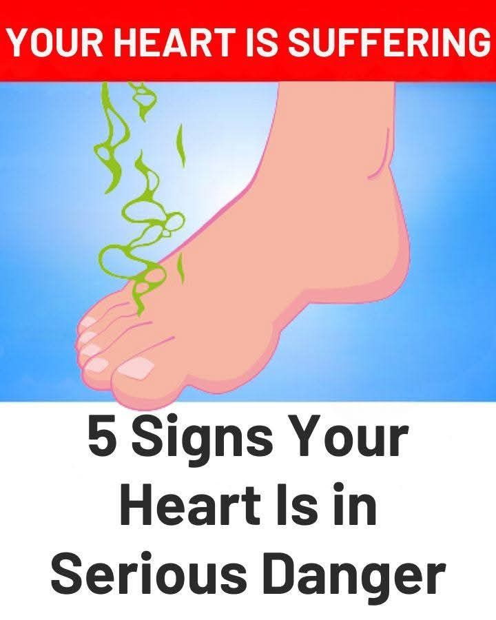 5 Signs Your Heart Is in Serious Dan.ger (link in 1st comment)