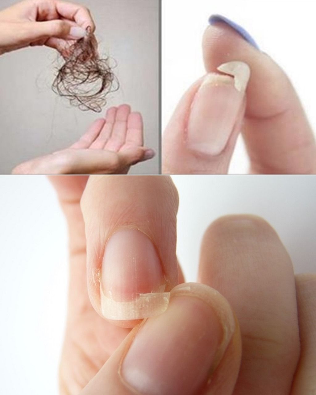 Home Remedy to Solve the Problem of Hair Loss and Brittle Nails