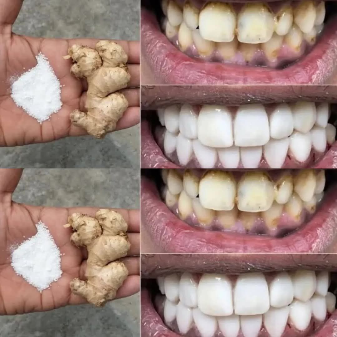 In two minutes, the white teeth whitening and globe such as pearls, this recipe / treatment at home