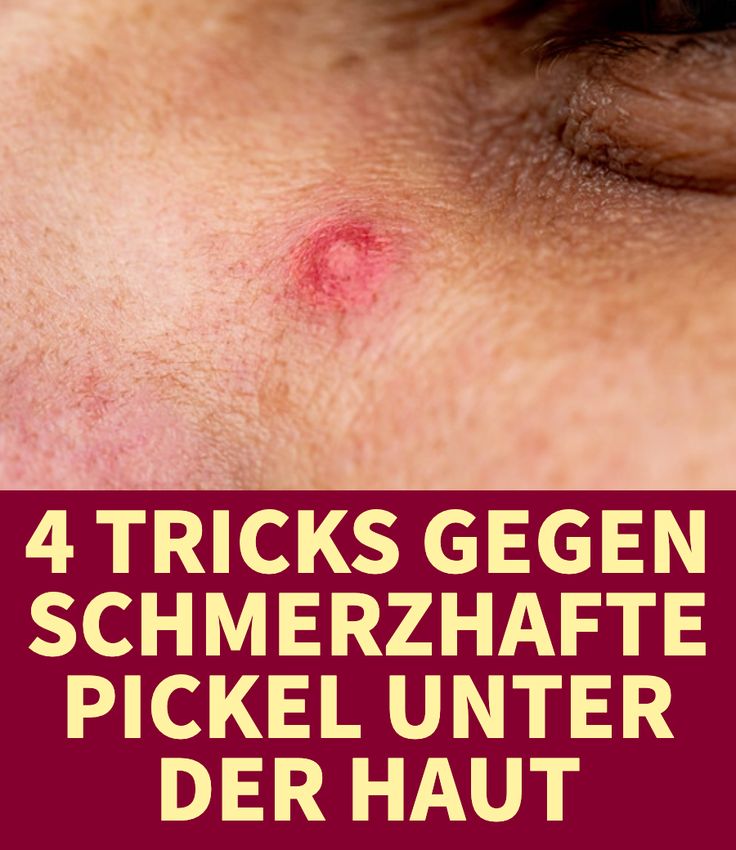 4 Tricks for a little pickle below the top