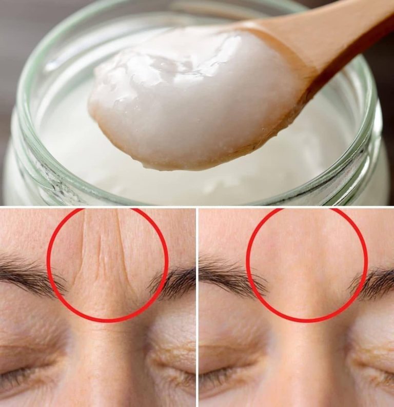 2 Masks to Reduce Forehead Wrinkles