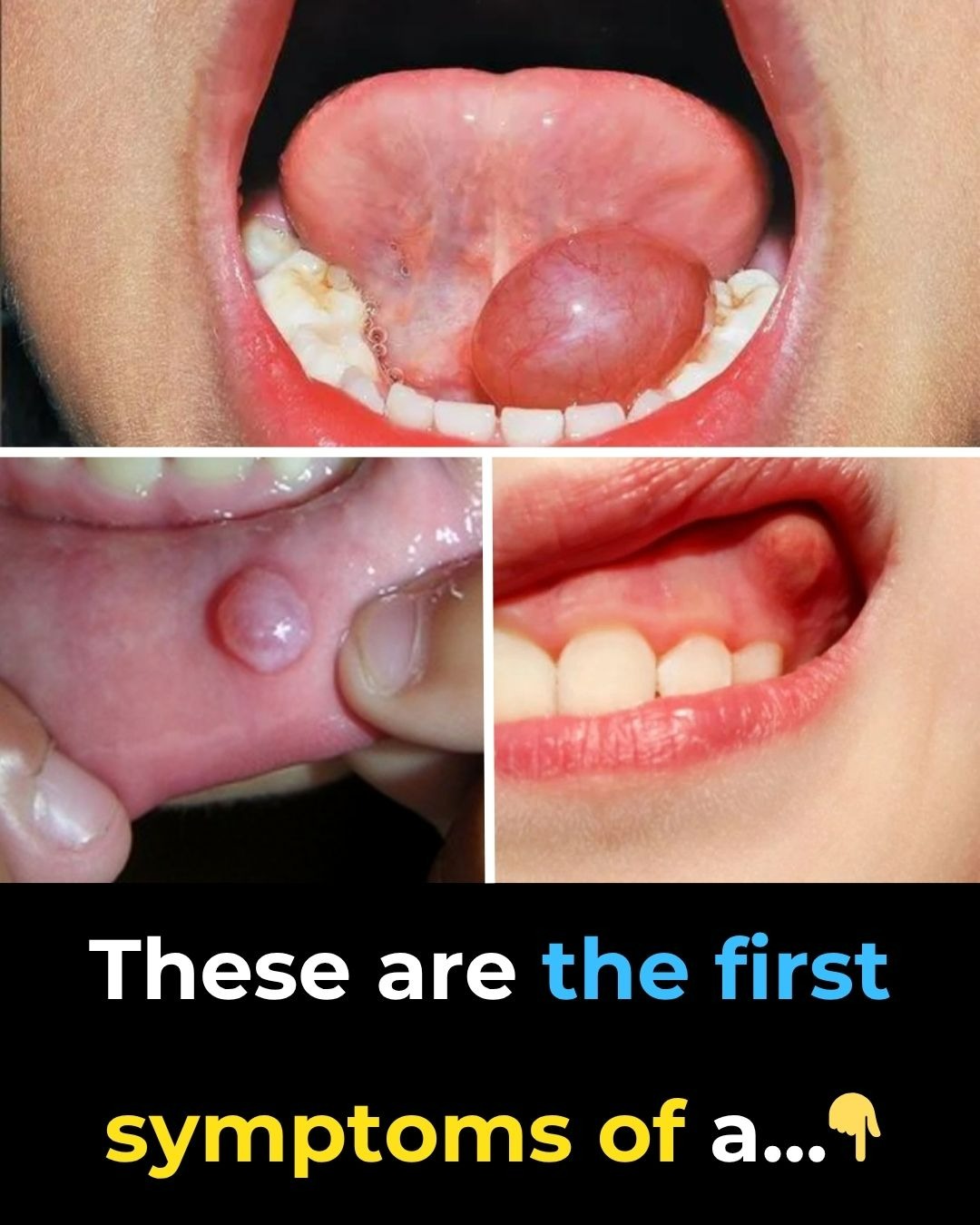 Hidden Dangers in Your Mouth: Early Signs of Oral Cancer You Should Never Ignore