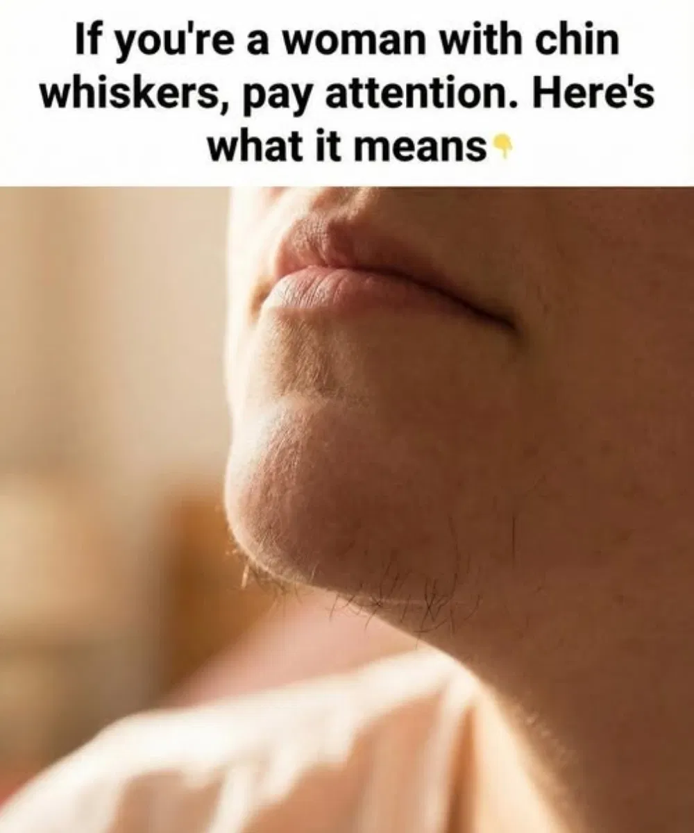 What Chin Hair in Women Really Says About Horm:ones