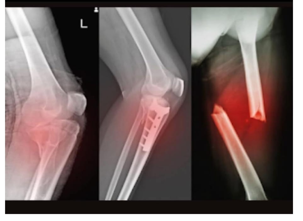 Take vitamin D and all these diseases will disappear.