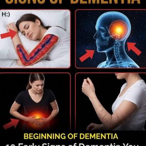 10 Signs of Dementia You Should Never Ignore