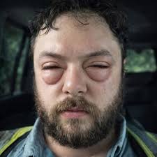 These are the consequences of sleeping with